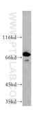Membrane Palmitoylated Protein 5 antibody, 17710-1-AP, Proteintech Group, Western Blot image 