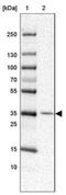 Ring Finger Protein 217 antibody, NBP1-88253, Novus Biologicals, Western Blot image 