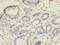 Ubiquitin Conjugating Enzyme E2 D1 antibody, CSB-PA025443DA01HU, Cusabio, Immunohistochemistry paraffin image 