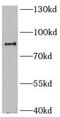 Myristoylated Alanine Rich Protein Kinase C Substrate antibody, FNab06404, FineTest, Western Blot image 