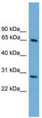 F-Box And WD Repeat Domain Containing 8 antibody, TA330940, Origene, Western Blot image 
