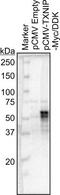 Thioredoxin Interacting Protein antibody, NBP1-54578, Novus Biologicals, Western Blot image 
