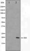 Glutamate Metabotropic Receptor 8 antibody, orb224487, Biorbyt, Western Blot image 