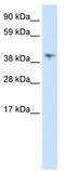 Male-specific lethal 3 homolog antibody, TA345488, Origene, Western Blot image 