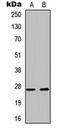 BPI Fold Containing Family A Member 1 antibody, orb234939, Biorbyt, Western Blot image 
