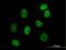 DAZ-associated protein 1 antibody, H00026528-B01P, Novus Biologicals, Immunocytochemistry image 