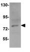 Protein Inhibitor Of Activated STAT 3 antibody, GTX31412, GeneTex, Western Blot image 