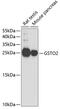 Glutathione S-Transferase Omega 2 antibody, 19-850, ProSci, Western Blot image 