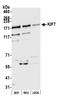 Kinesin-like protein KIF7 antibody, A302-709A, Bethyl Labs, Western Blot image 