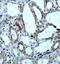 Ectonucleoside Triphosphate Diphosphohydrolase 4 antibody, orb78294, Biorbyt, Immunohistochemistry paraffin image 