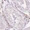 Zinc finger protein 639 antibody, NBP2-49035, Novus Biologicals, Immunohistochemistry paraffin image 