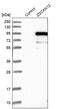 Zinc Finger And SCAN Domain Containing 12 antibody, PA5-52315, Invitrogen Antibodies, Western Blot image 
