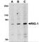 Probable ATP-dependent RNA helicase DDX58 antibody, TA306359, Origene, Western Blot image 