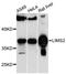 LIM Zinc Finger Domain Containing 2 antibody, LS-C748284, Lifespan Biosciences, Western Blot image 