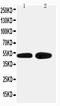 Adrenoceptor Alpha 2A antibody, PA2197, Boster Biological Technology, Western Blot image 