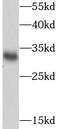 DHSB antibody, FNab07670, FineTest, Western Blot image 