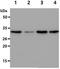 Glutathione S-Transferase Theta 2 (Gene/Pseudogene) antibody, NBP2-50577, Novus Biologicals, Western Blot image 