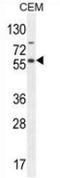 NFKB Inhibitor Like 1 antibody, AP52865PU-N, Origene, Western Blot image 