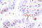 DNA repair protein XRCC3 antibody, LS-C176372, Lifespan Biosciences, Immunohistochemistry frozen image 