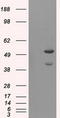 RAC-beta serine/threonine-protein kinase antibody, CF500808, Origene, Western Blot image 