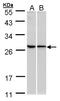 Ribosomal Protein L13a antibody, LS-C185476, Lifespan Biosciences, Western Blot image 