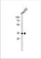 FosB Proto-Oncogene, AP-1 Transcription Factor Subunit antibody, TA324882, Origene, Western Blot image 