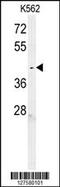 Chromosome 6 Open Reading Frame 58 antibody, 55-011, ProSci, Western Blot image 