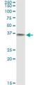 Biliverdin Reductase A antibody, H00000644-M03, Novus Biologicals, Immunoprecipitation image 