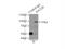 Lysine Acetyltransferase 2B antibody, 13983-1-AP, Proteintech Group, Immunoprecipitation image 