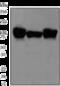 Actinin Alpha 2 antibody, ab68167, Abcam, Western Blot image 