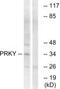 Serine/threonine-protein kinase PRKY antibody, PA5-39442, Invitrogen Antibodies, Western Blot image 