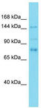 SOS Ras/Rac Guanine Nucleotide Exchange Factor 1 antibody, TA343296, Origene, Western Blot image 