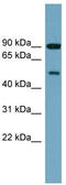 Phosphatidylinositol 4-Kinase Type 2 Beta antibody, TA344877, Origene, Western Blot image 