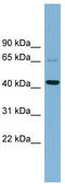 UEV And Lactate/Malate Dehyrogenase Domains antibody, TA344884, Origene, Western Blot image 