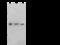 Actinin Alpha 1 antibody, 104759-T36, Sino Biological, Western Blot image 
