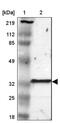 Glutathione S-Transferase Theta 2 (Gene/Pseudogene) antibody, NBP1-86186, Novus Biologicals, Western Blot image 