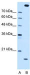 Melanoma inhibitory activity protein 2 antibody, TA346487, Origene, Western Blot image 
