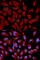 DNA Methyltransferase 3 Alpha antibody, A2065, ABclonal Technology, Immunofluorescence image 