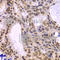 DNA Polymerase Delta 3, Accessory Subunit antibody, A7243, ABclonal Technology, Immunohistochemistry paraffin image 