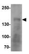 Crumbs homolog 1 antibody, GTX32103, GeneTex, Western Blot image 