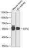 SUFU Negative Regulator Of Hedgehog Signaling antibody, A6757, ABclonal Technology, Western Blot image 