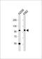 Coatomer Protein Complex Subunit Gamma 1 antibody, 60-774, ProSci, Western Blot image 