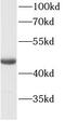 Keratin 20 antibody, FNab02213, FineTest, Western Blot image 