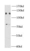 Cbl Proto-Oncogene antibody, FNab01317, FineTest, Western Blot image 