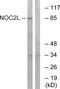 NOC2 Like Nucleolar Associated Transcriptional Repressor antibody, A11194, Boster Biological Technology, Western Blot image 