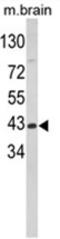 Aspartate aminotransferase, cytoplasmic antibody, AP18039PU-N, Origene, Western Blot image 