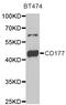 CD177 antigen antibody, orb255286, Biorbyt, Western Blot image 