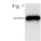 E3 ubiquitin-protein ligase SHPRH antibody, PA1-4315, Invitrogen Antibodies, Western Blot image 