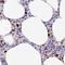 DENN Domain Containing 1C antibody, NBP1-94051, Novus Biologicals, Immunohistochemistry paraffin image 
