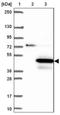 Coiled-Coil Domain Containing 189 antibody, NBP2-30829, Novus Biologicals, Western Blot image 